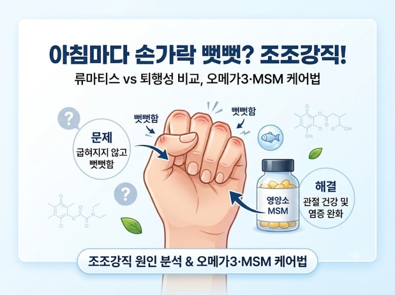 아침마다 손가락 마디가 뻣뻣하고 잘 안 쥐어진다면? 조조강직 원인과 류마티스 vs 퇴행성 비....