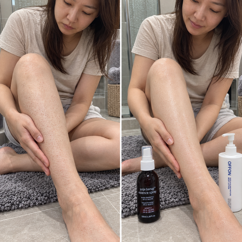 다리 모공각화증 로션 선택만 잘해도 피부가 달라져요.
