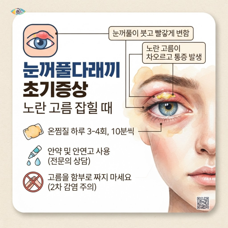 눈꺼풀다래끼 초기증상 노란 고름 잡힐 때 대처 방법 및 치료 팁