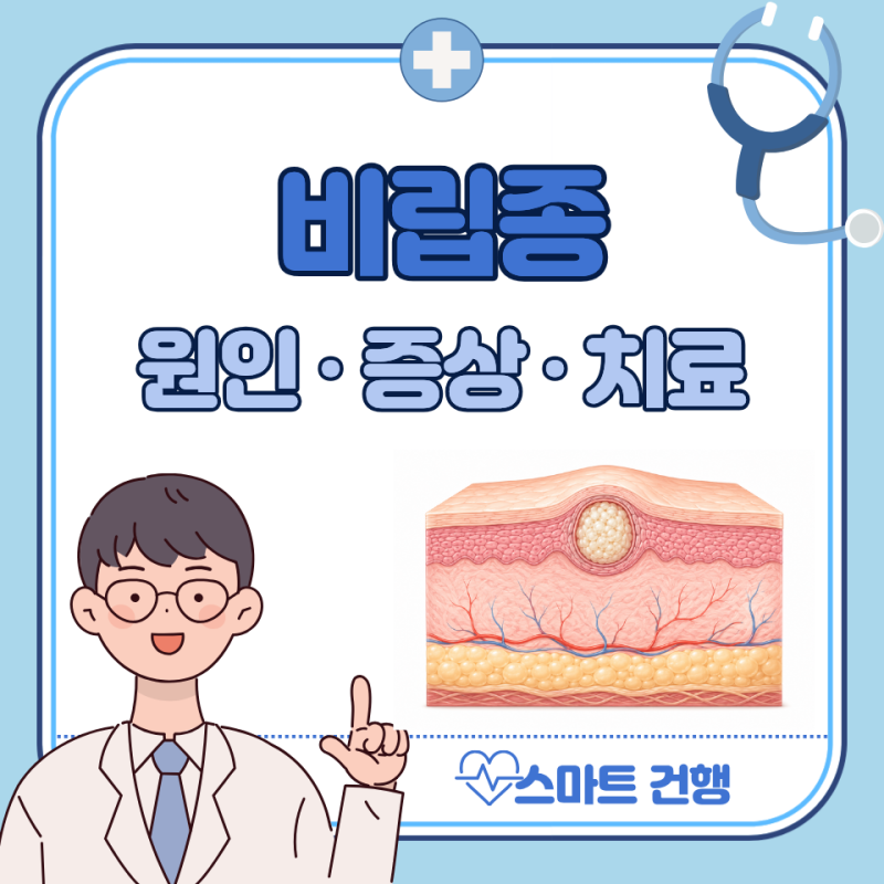 비립종 원인, 제거 후 관리, 연고 : 눈밑, 눈꺼풀 제거 비용