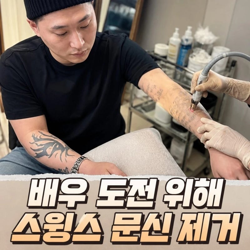 스윙스 문신 제거 연기 위해 지우는 이유 공개