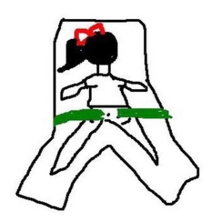 똥꼬(치질aka.치핵)수술 후기 - 1편