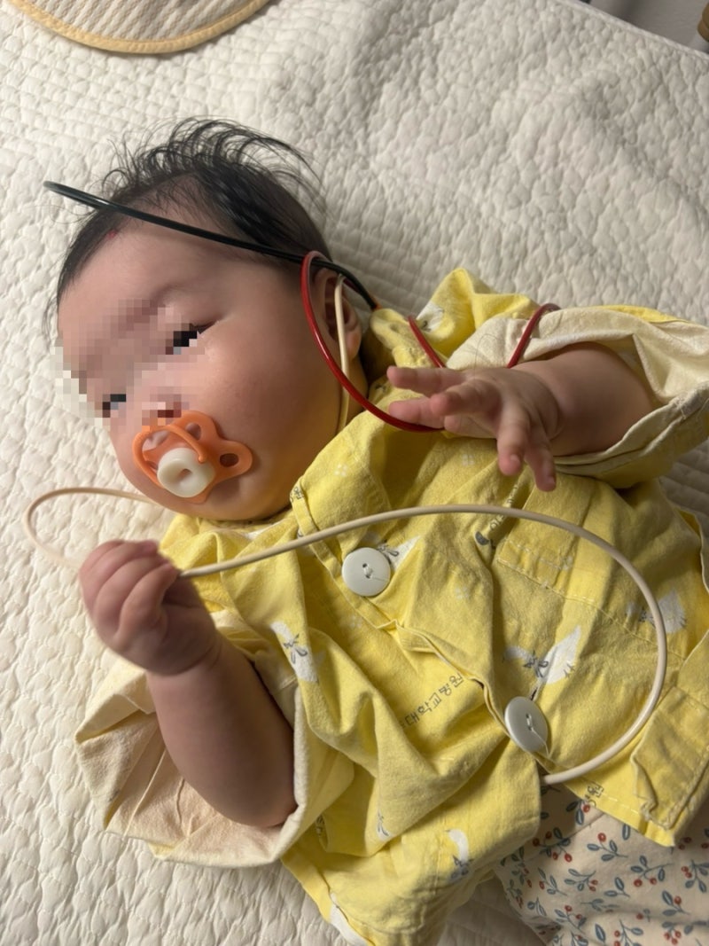 156일 아기일기 : 혈관종 치료하기(닥브네로우 일회용 젖병 추천: 유미 이지고)