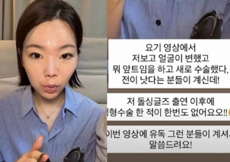 이다은 성형의혹 직접 해명…"코 무너지면 하려고요" 솔직 고백 총정리