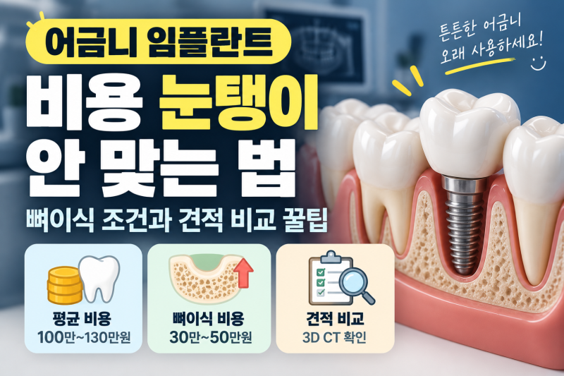 어금니 임플란트 비용 눈탱이 안 맞는 법: 뼈이식 조건과 견적 비교 꿀팁