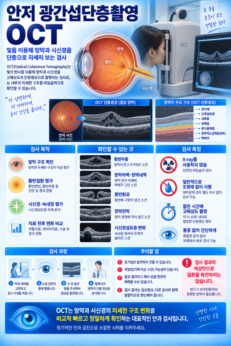 안저 광간섭단층촬영(OCT), 눈 속을 ‘단면으로 잘라 보듯’ 본다? 황반과 시신경 손상을 찾아....
