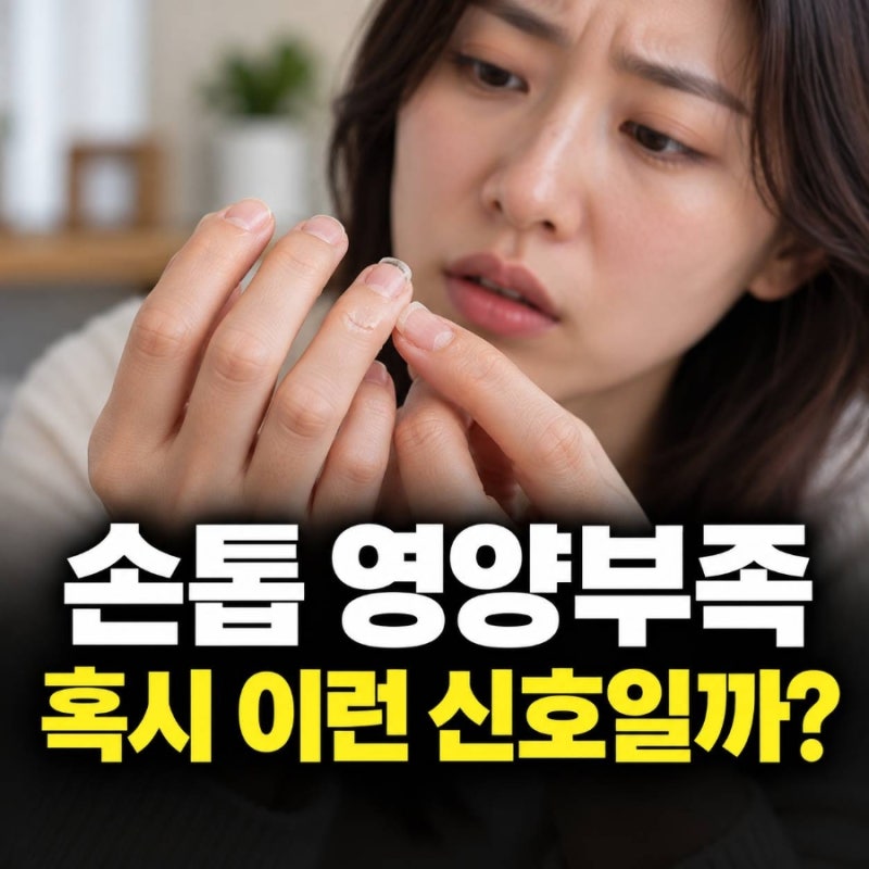 손톱 영양부족, 자꾸 깨지고 갈라진다면 부족한 게 뭘까?