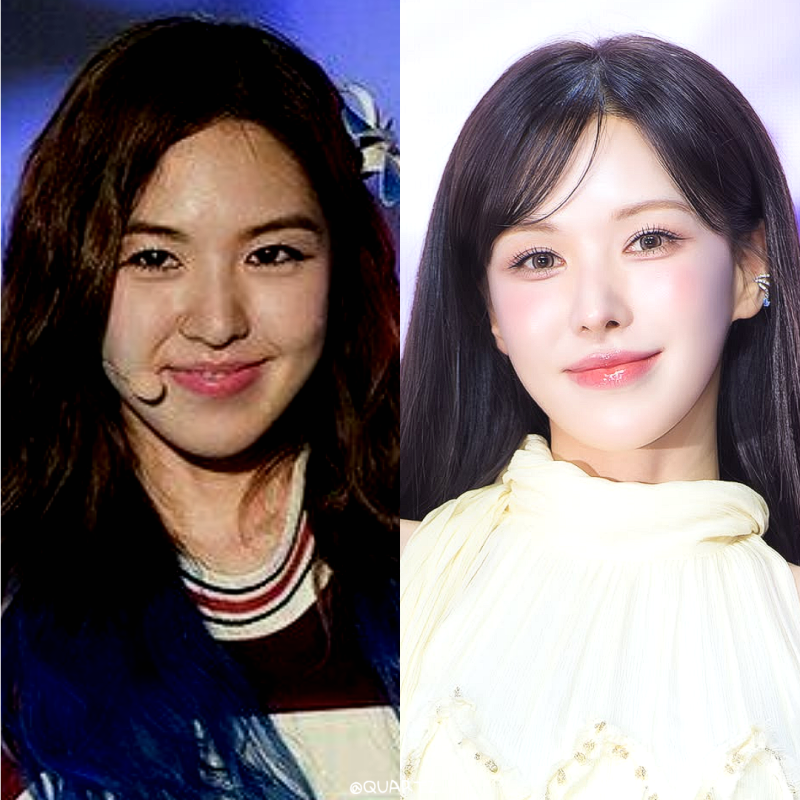 레드벨벳 웬디 골반뽕 논란? 팬들의 걱정을 산 뼈말라 몸매