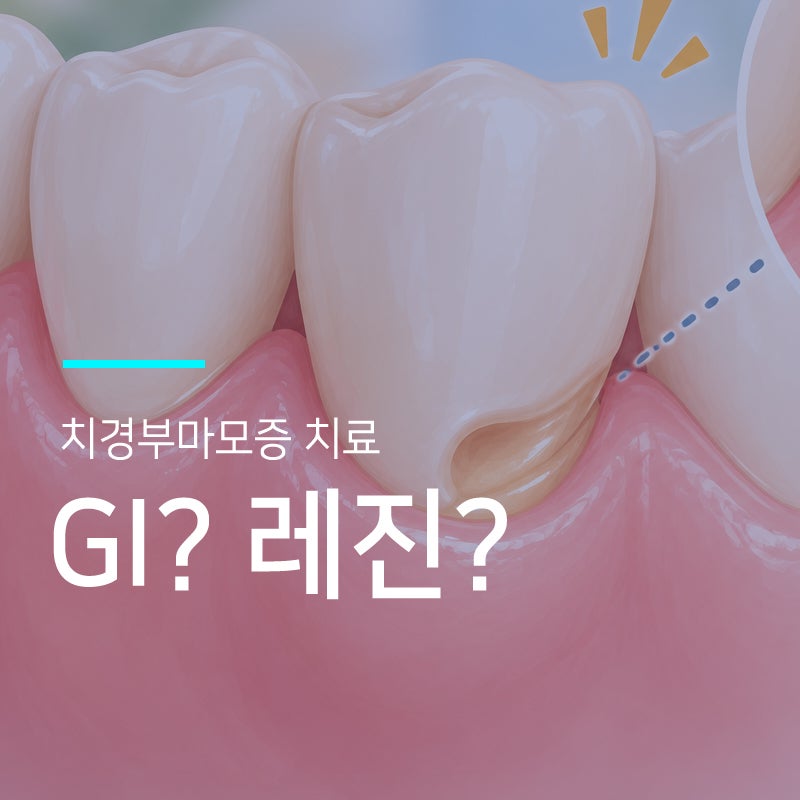 구로 치경부 마모증 치료하는 치과, GI와 레진 치료 어떻게 선택할까요?