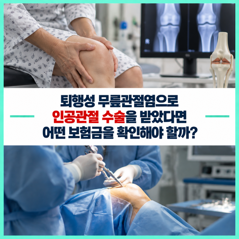 퇴행성 무릎관절염으로 인공관절 수술을 받았다면 어떤 보험금을 확인해야 할까?