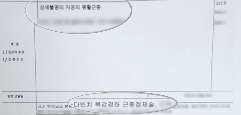 자궁근종 로봇수술 비용 얼마일까? 다빈치 수술 보험금 청구