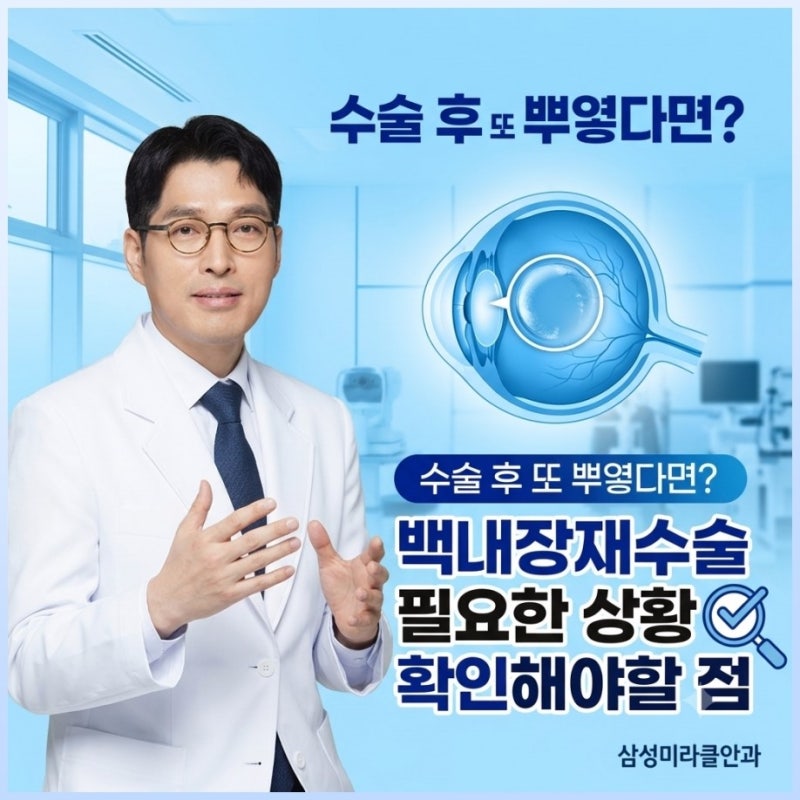 백내장재수술 필요한 상황과 확인해야할 점