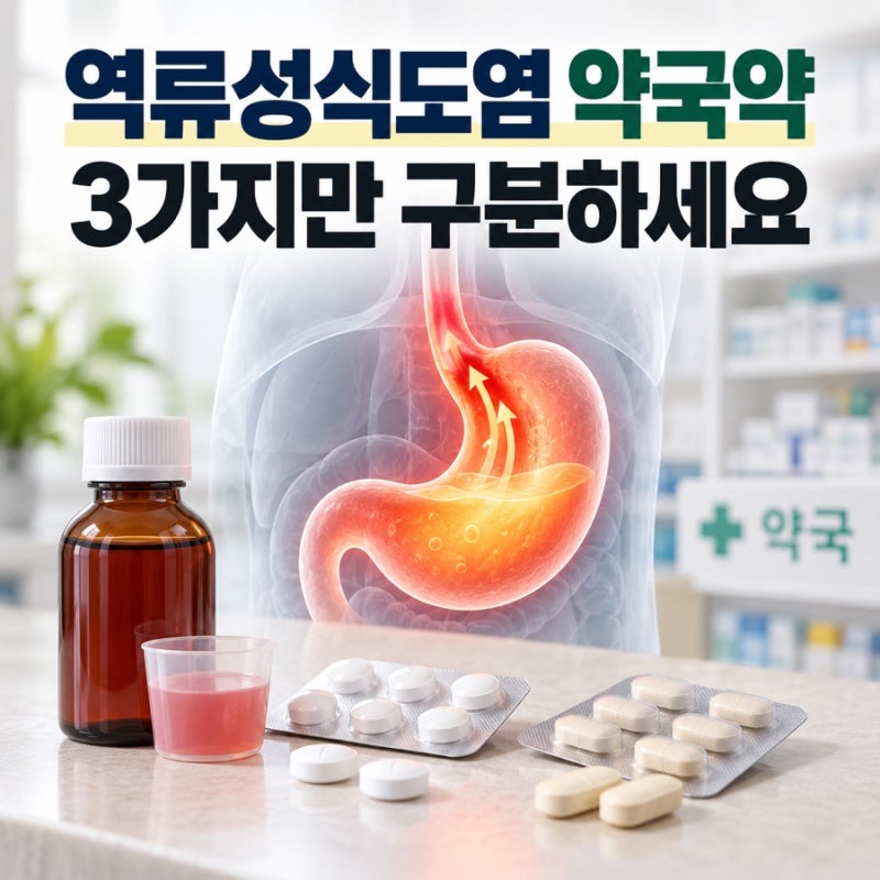 역류성식도염 약국약 종류｜속쓰림·신물에 따라 고르는 법과 병원 가야 할 때