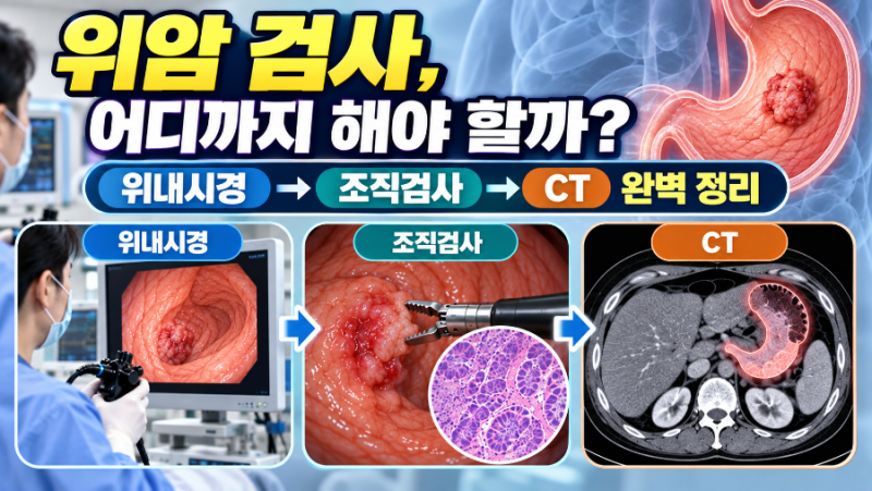 위암 3회|위암 검사 방법 총정리｜위내시경·조직 검사· CT는 언제 필요할까?