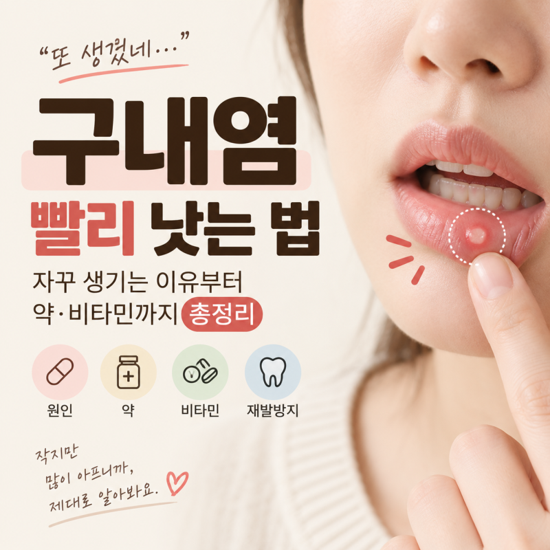 구내염 빨리 낫는 법｜자꾸 생기는 이유부터 약·비타민까지 총정리