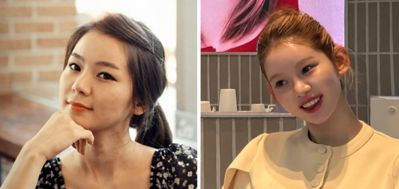 맹승지, 인중 성형 2개월 차 “흉터 아직 빨갛다”… 전후 보니 얼굴 비율이 달라졌다