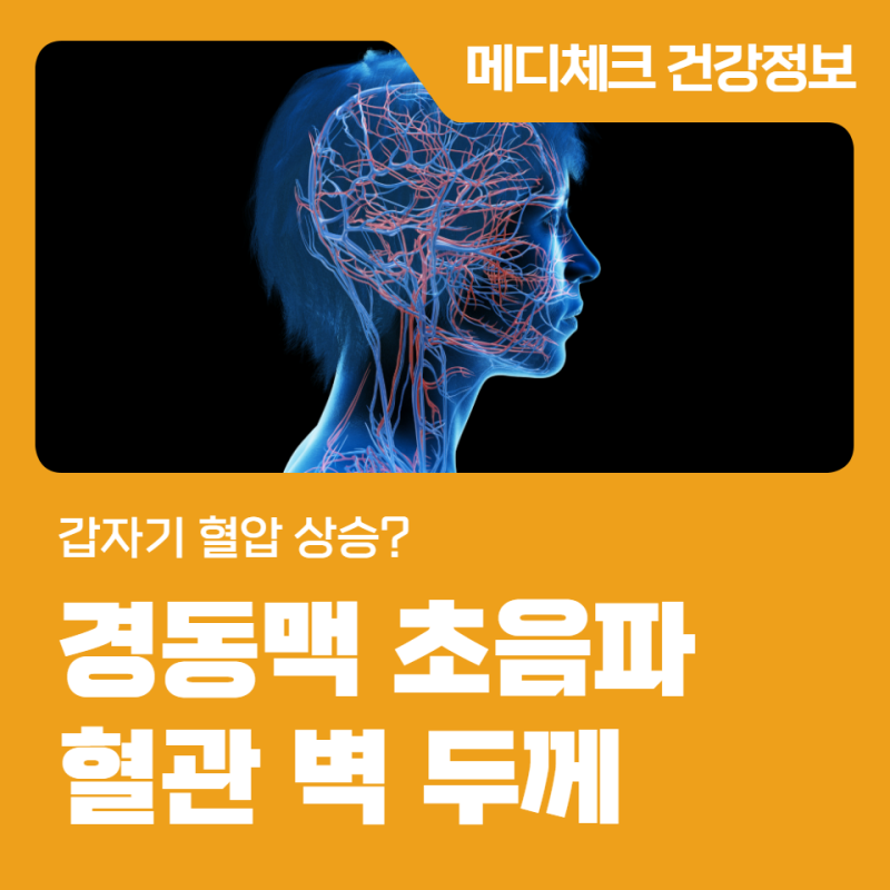 부산 건강검진 갑자기 혈압 상승? 경동맥 초음파 혈관 벽 두께 측정