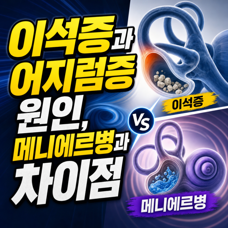 이석증과 어지럼증 원인, 메니에르병과 차이점