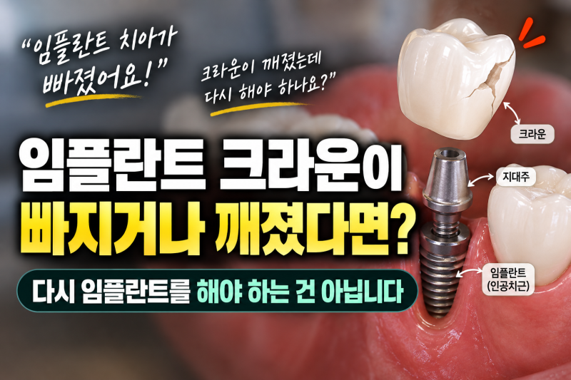 임플란트 크라운이 빠지거나 깨졌다면? 다시 임플란트를 해야 하는 건 아닙니다