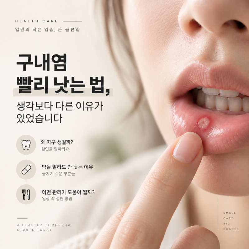 구내염 빨리 낫는 법, 계속 안 낫는 이유가 따로 있었습니다