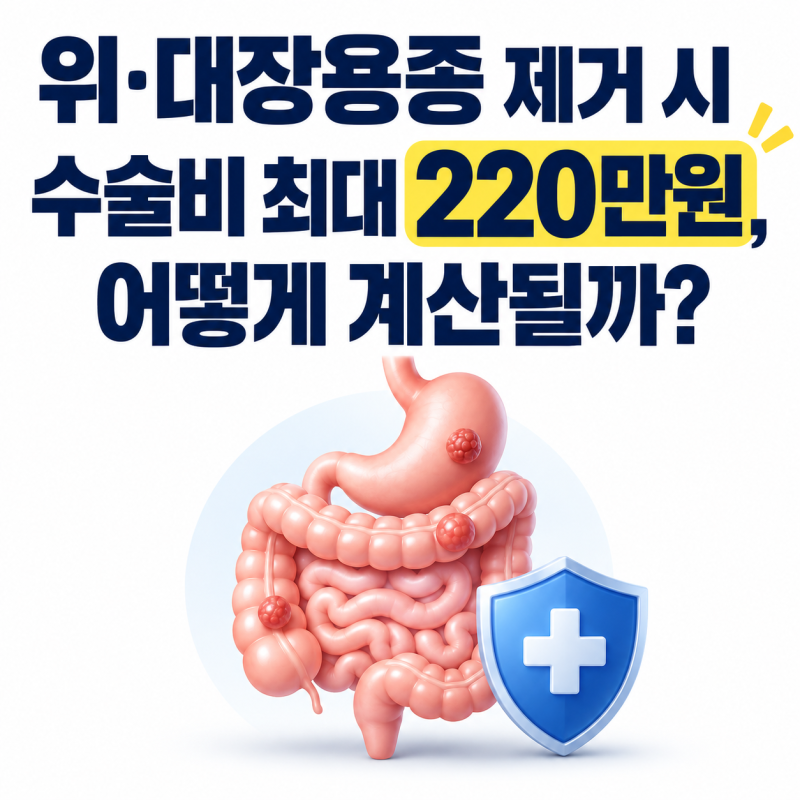 위·대장용종 제거 시 수술비 최대 220만원, 어떻게 계산될까?