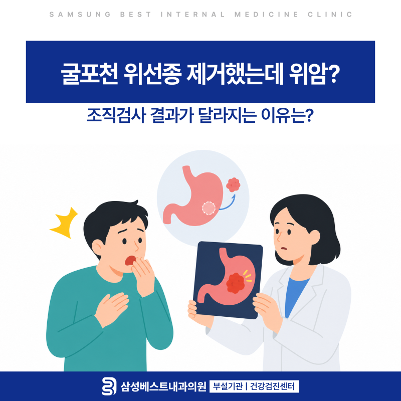 굴포천 위선종 제거했는데 위암? 조직검사 결과가 달라지는 이유는?