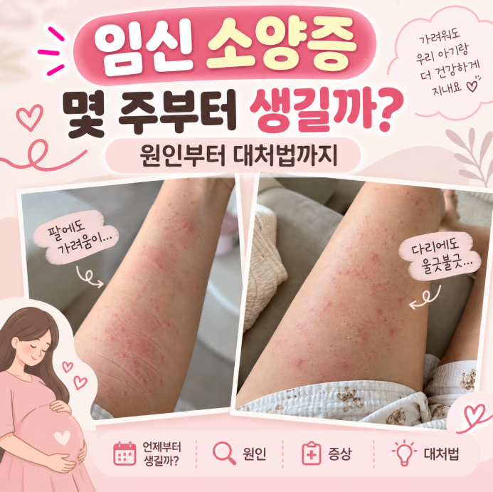 임신 소양증｜몇 주부터 생길까? 원인부터 대처법까지