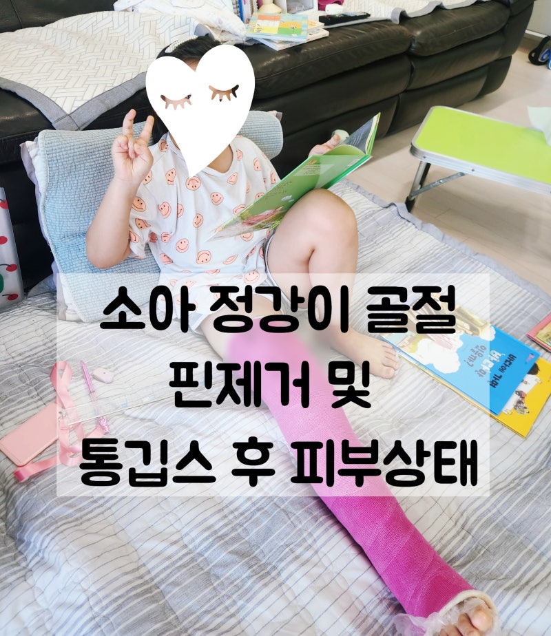 아이 다리 골절 핀 제거 후기, 통깁스 피부 벗김 관리와 재활 과정