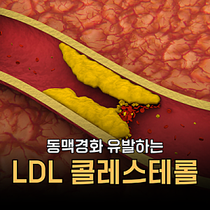 LDL HDL 콜레스테롤 정상수치 높으면 낮으면 증상 및 저밀도 낮추는 법, 고밀도 높이는 방법