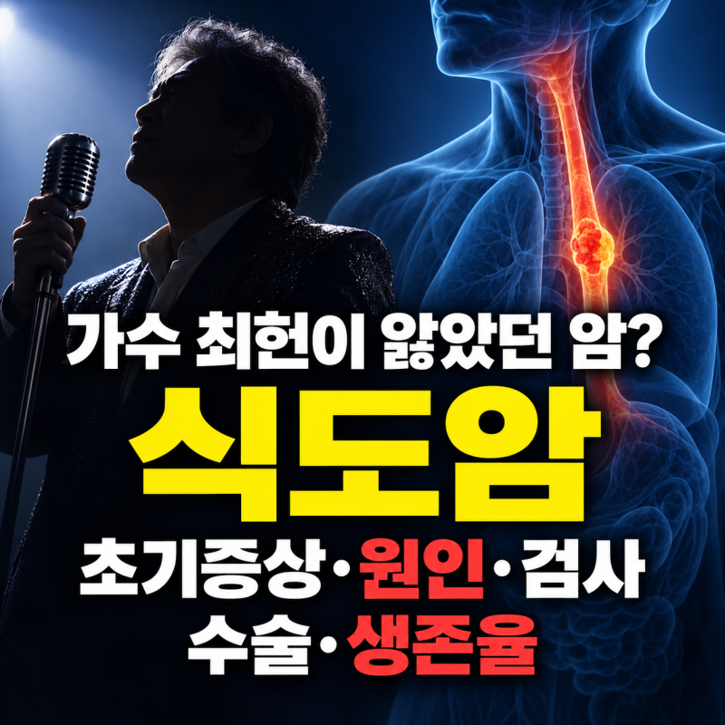 가수 최헌이 앓았던 암?식도암 초기증상·원인·검사·수술·생존율