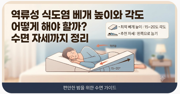 역류성 식도염 베개 높이와 각도 어떻게 해야 할까? 수면 자세까지 정리