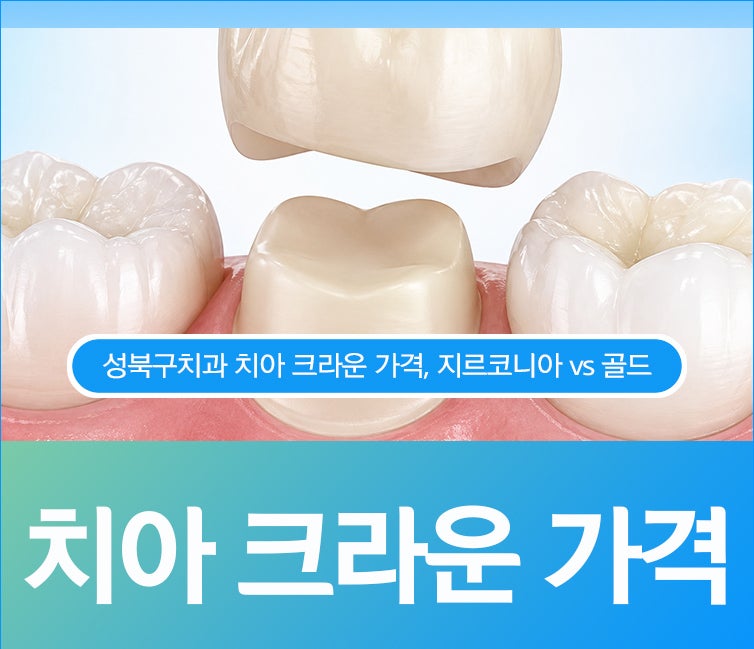 성북구치과 치아 크라운 가격, 지르코니아 vs 골드