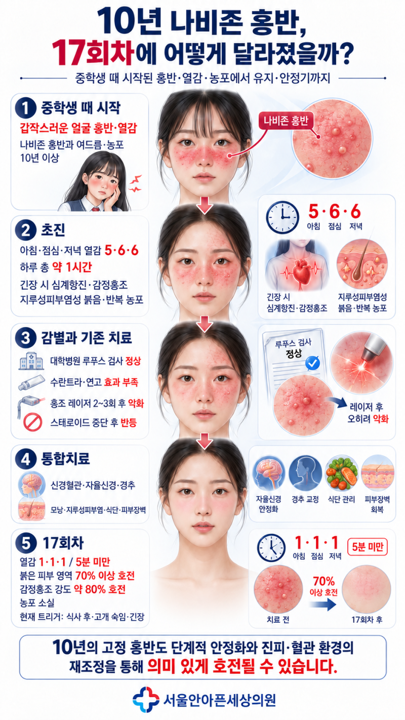 신경성 주사피부염 치료후기｜10년 나비존 홍반·감정홍조, 17회 치료 후 호전 사례- 서울안....