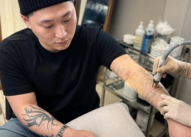 "몸을 도화지로 만들려고..." 스윙스 타투 제거 후 피어싱 흔적까지 지우는 미친 집념!