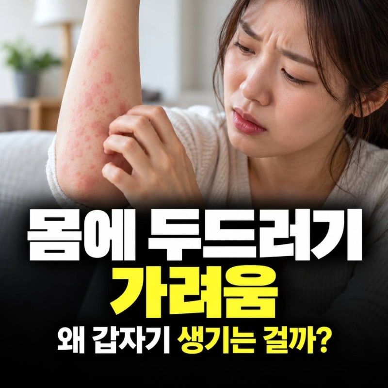 몸에 두드러기 가려움, 갑자기 올라오는 원인은 무엇일까?