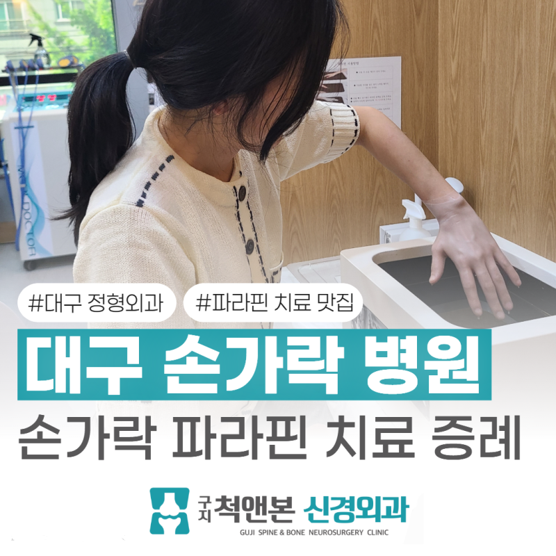 대구 손가락 병원, 손가락 마디가 아프다면, 파라핀 치료 전에 확인할 것