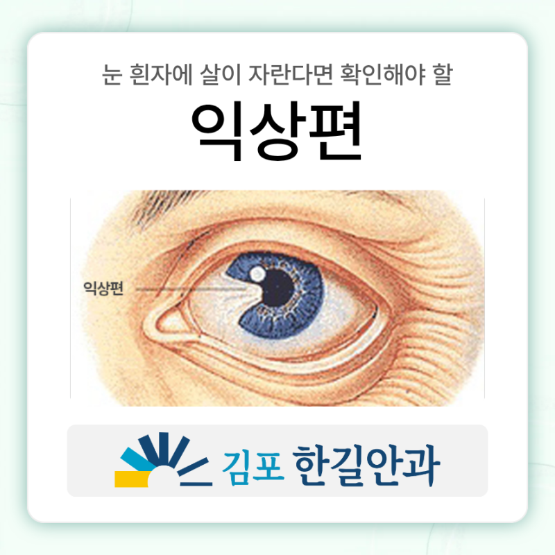 풍무동익상편치료 눈 흰자에 살이 자란다면 확인해야 할 익상편