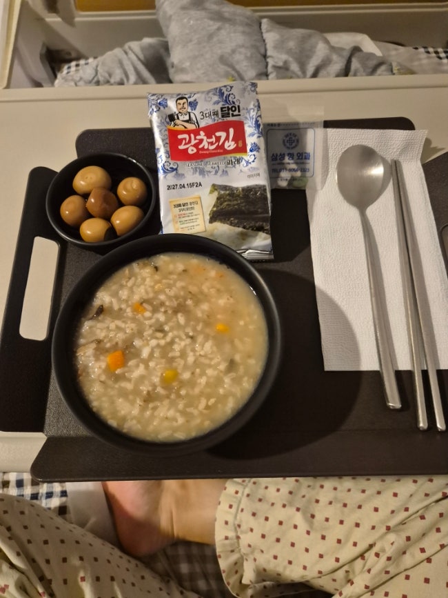 치핵수술후기 1일차부터 10일차까지