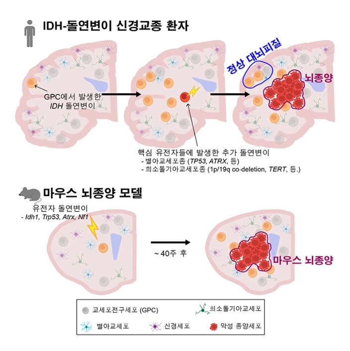 뇌종양 초기증상, 치료, 원인, 양성뇌종양