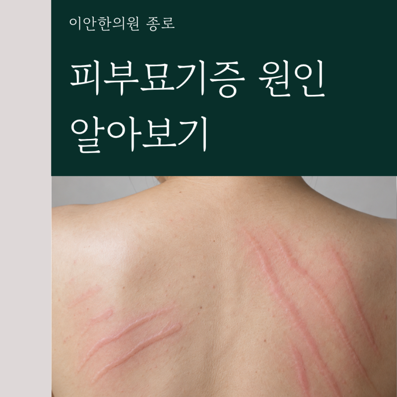 피부묘기증 원인 알아보기, 긁으면 부풀어 오르는 이유일까요?