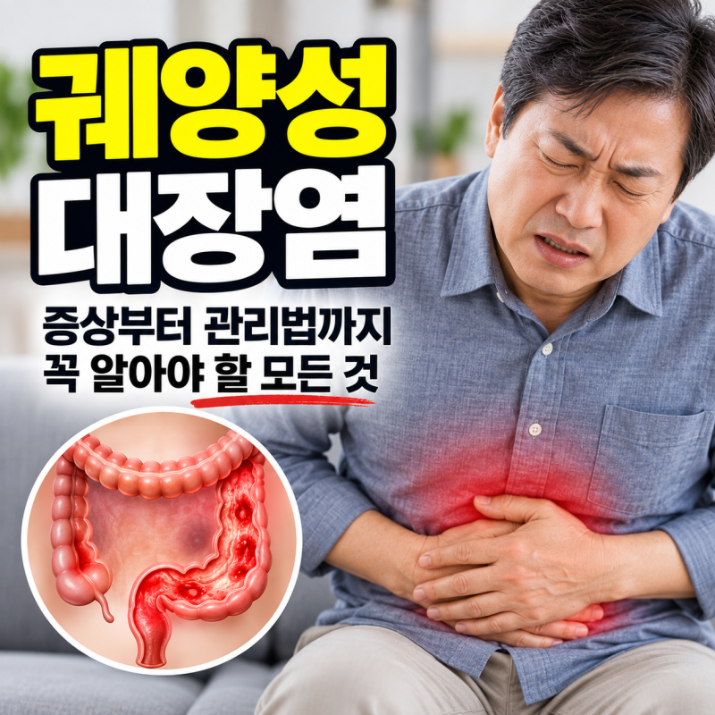 궤양성 대장염 증상과 원인, 치료법 총정리