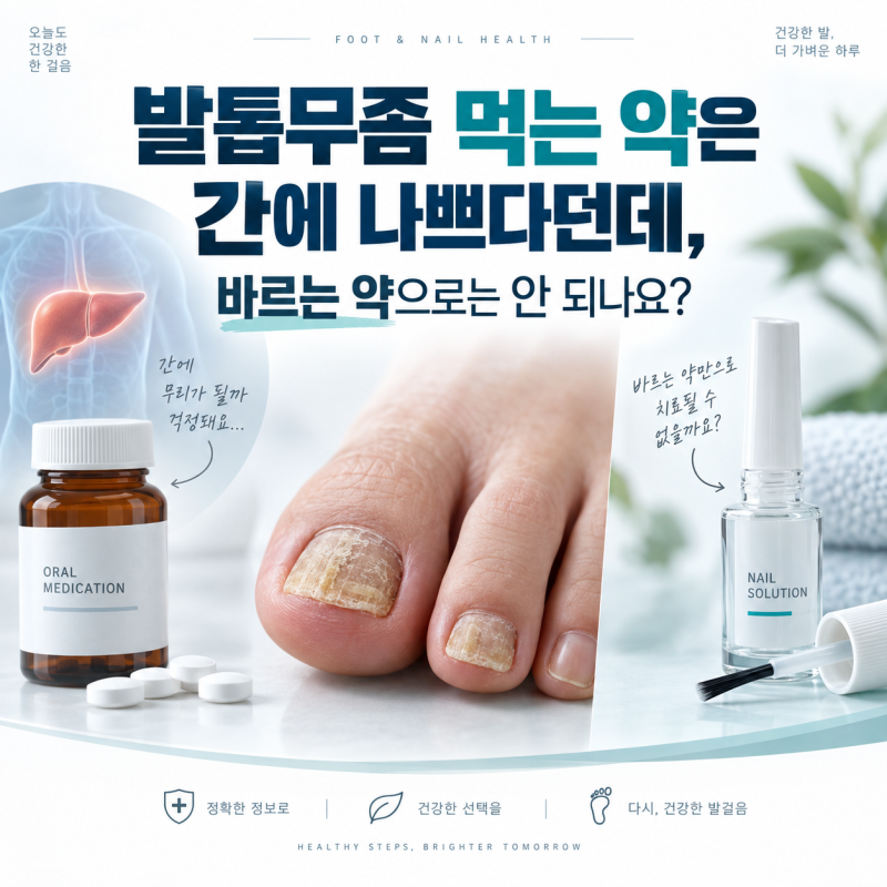 발톱무좀 먹는 약은 간에 나쁘다던데,바르는 약으로는 안 되나요?