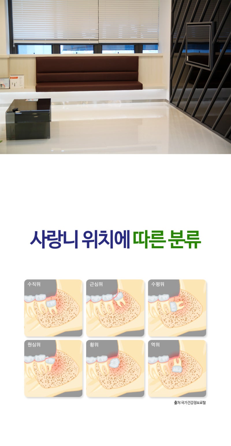 중화산동 사랑니 발치 후 러닝은 언제부터 해도 될까요?
