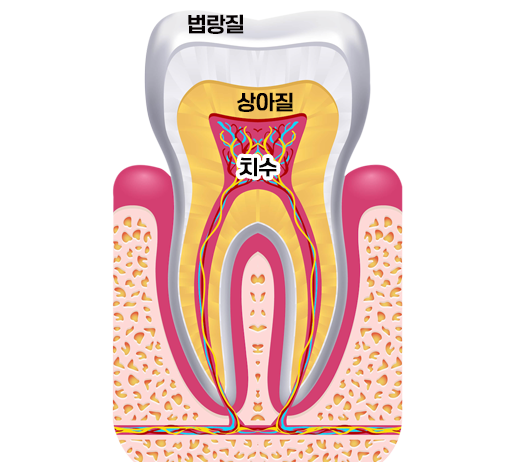 초기 충치, 꼭 바로 치료해야 할까? (진행 단계별 가이드)