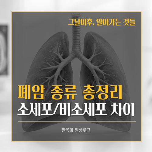 [폐암]폐암 종류 총정리｜소세포폐암과 비소세포폐암 차이