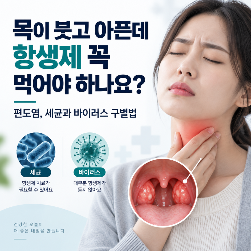 목이 붓고 아픈데 항생제 꼭 먹어야 하나요?편도염, 세균과 바이러스 구별법