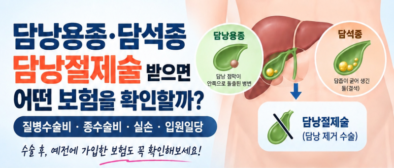 담낭용종 · 담석증, 담낭절제술 받으면 어떤 보험을 확인해야 할까?