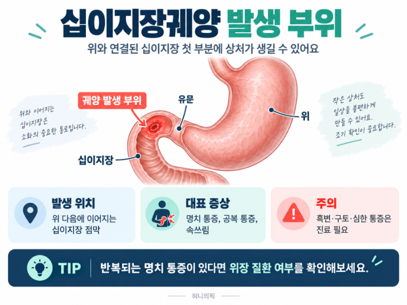 십이지장궤양 증상과 관리법