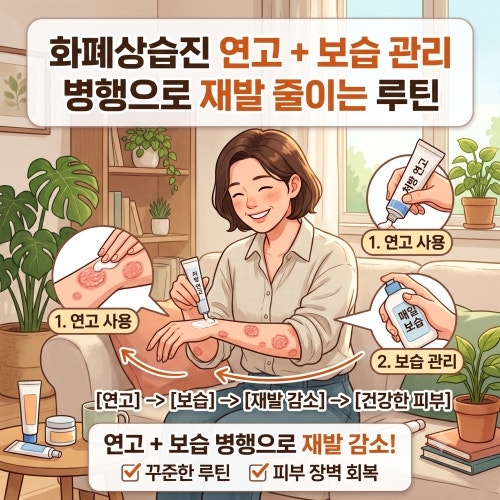 화폐상습진 연고 보습 관리 병행으로 재발 줄인는 루틴