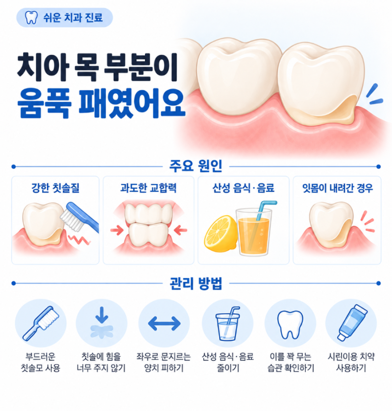 치아 목 부분이 움푹 패였어요, 충치가 아닌데 왜 생기나요?